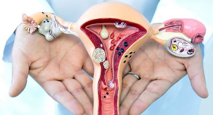 Cáncer cervicouterino, segunda causa de muerte de mujeres